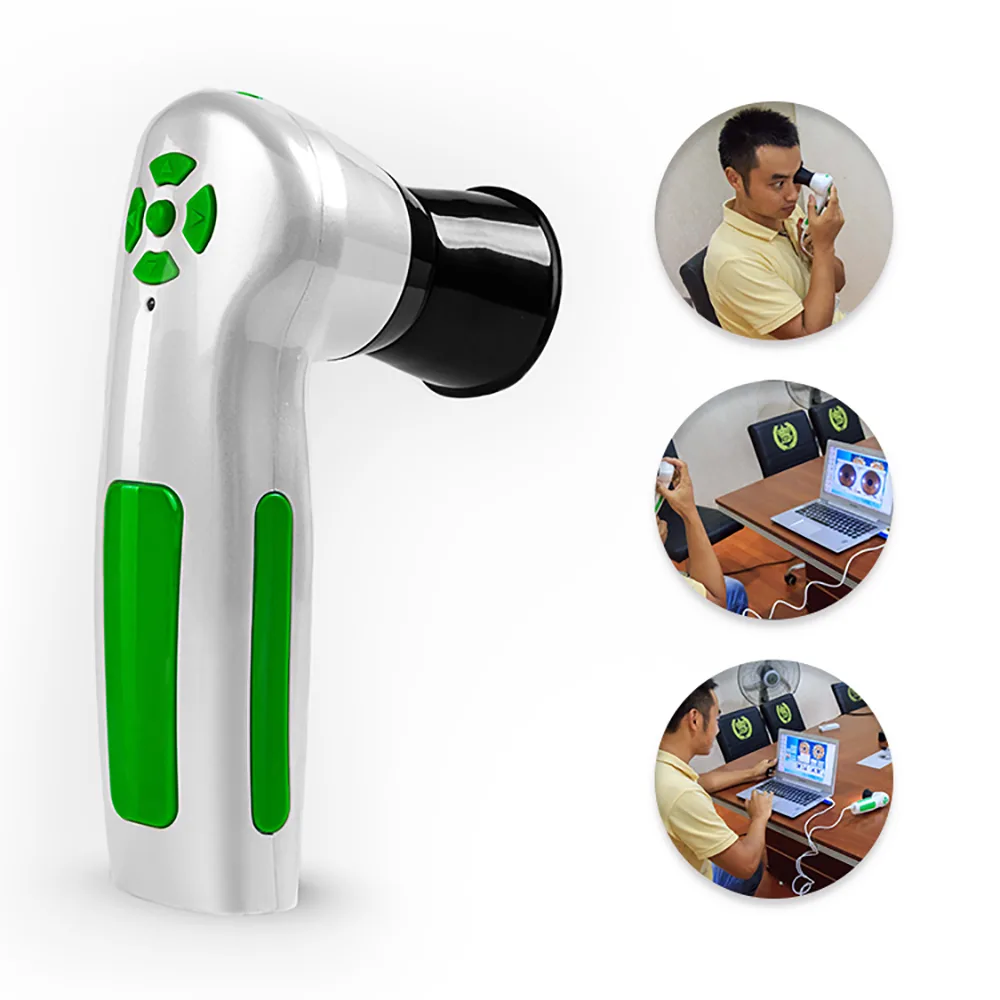 USB iriscope