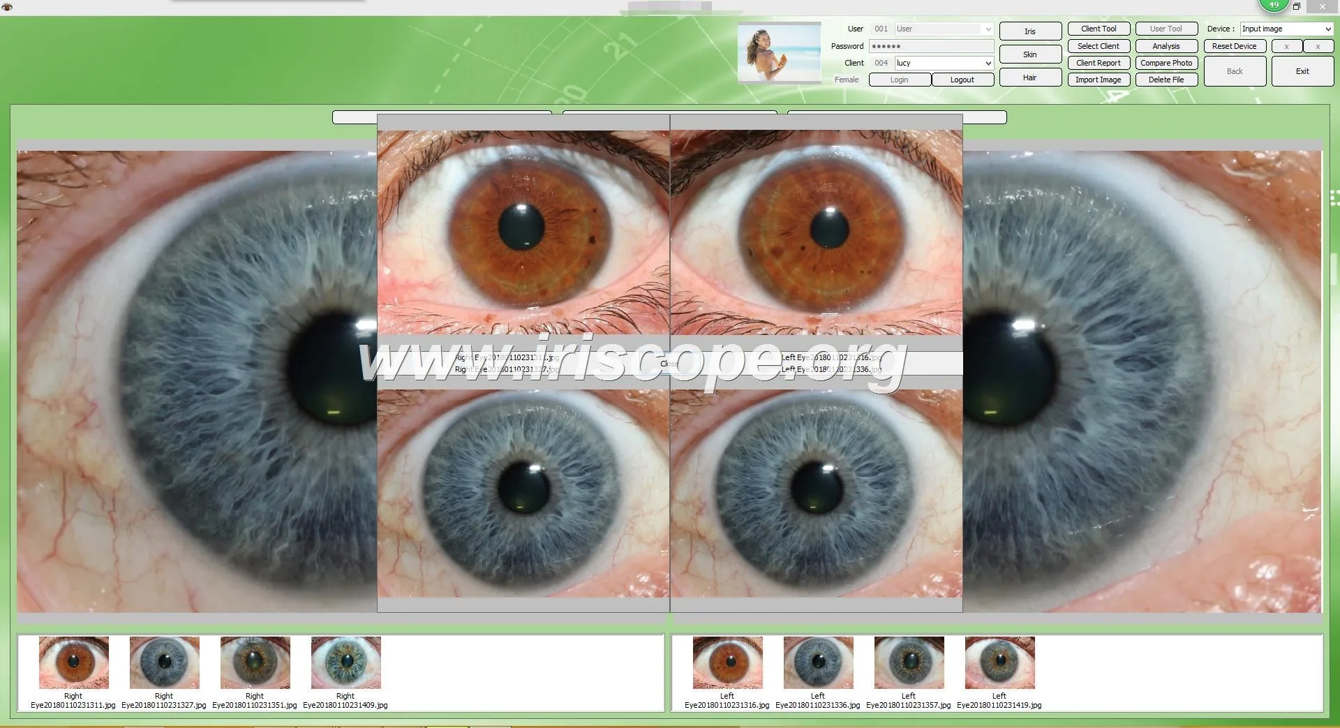 USB iriscope