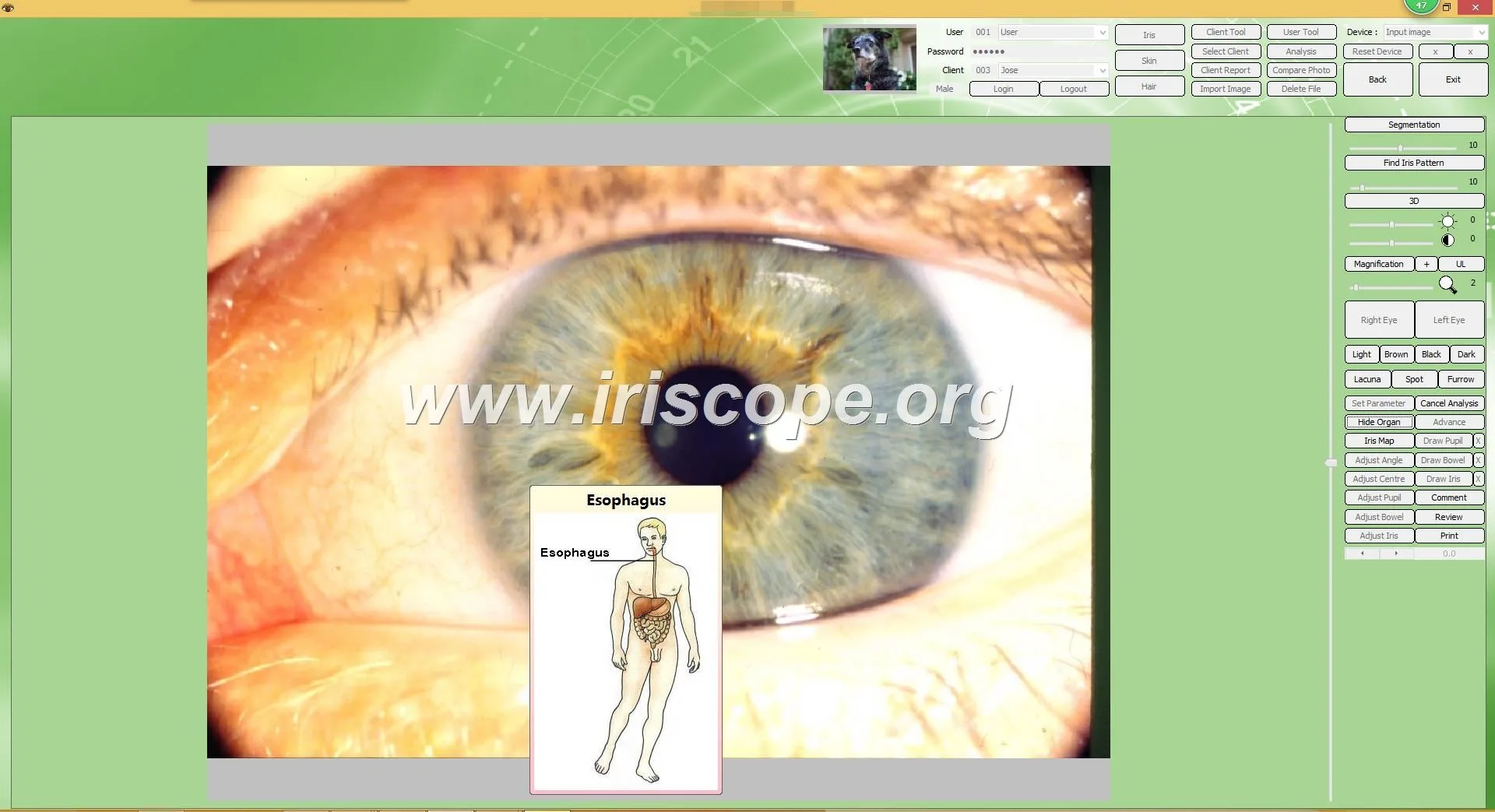 USB iriscope