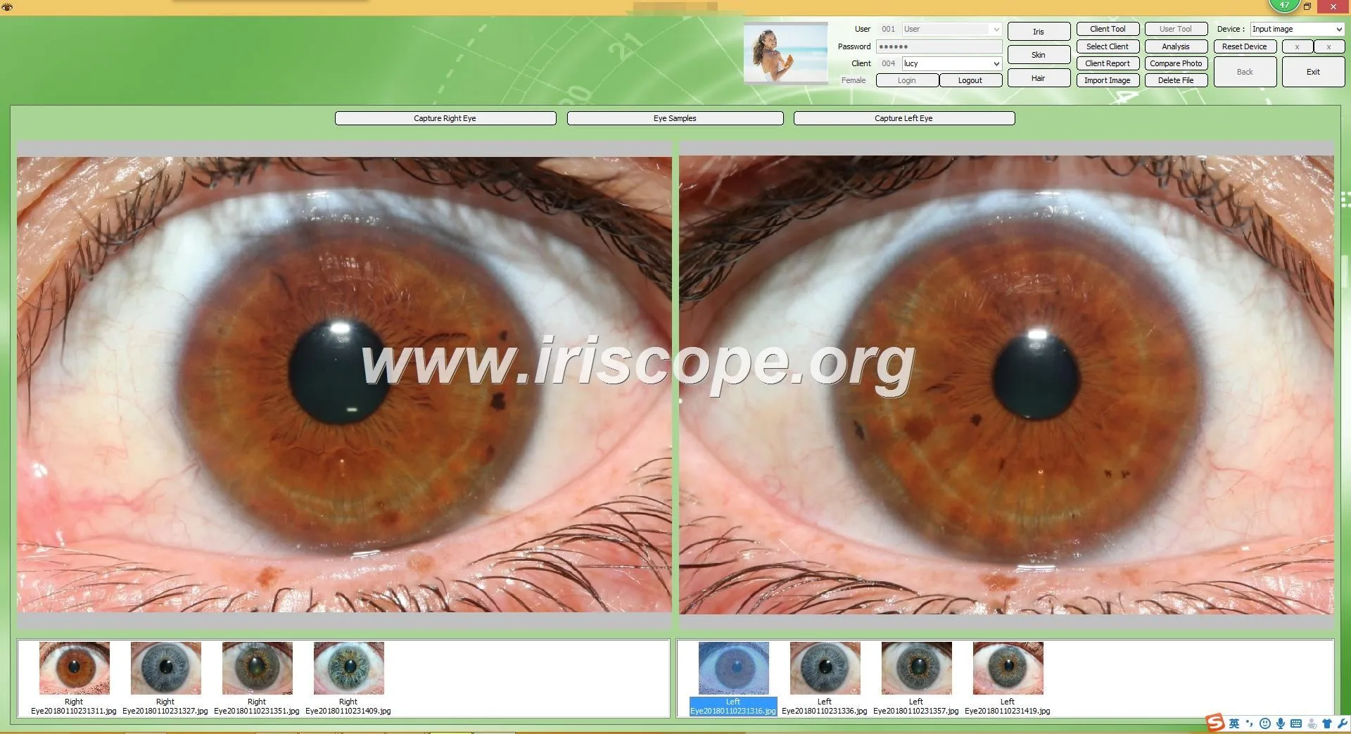 USB iriscope