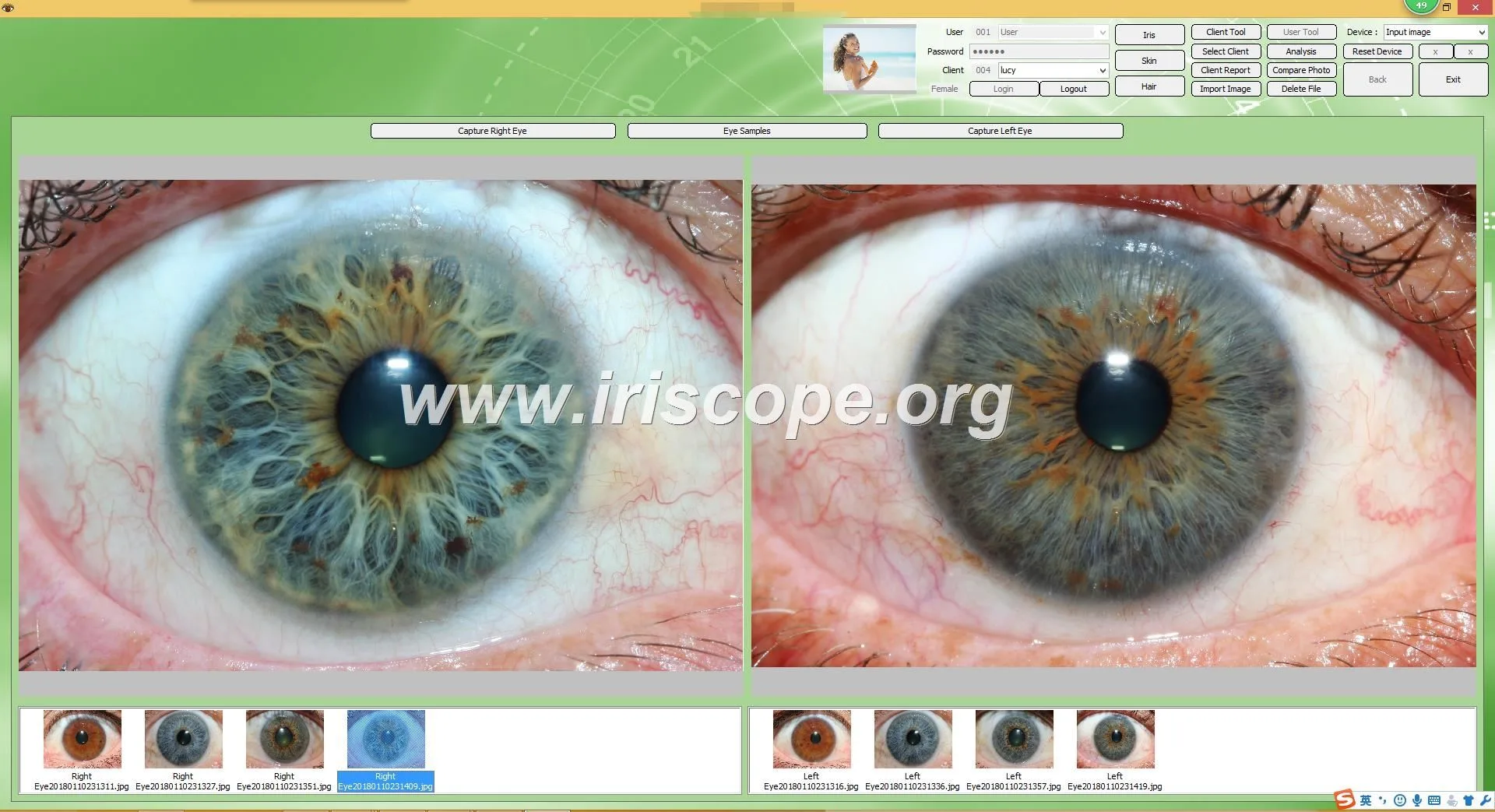 USB iriscope