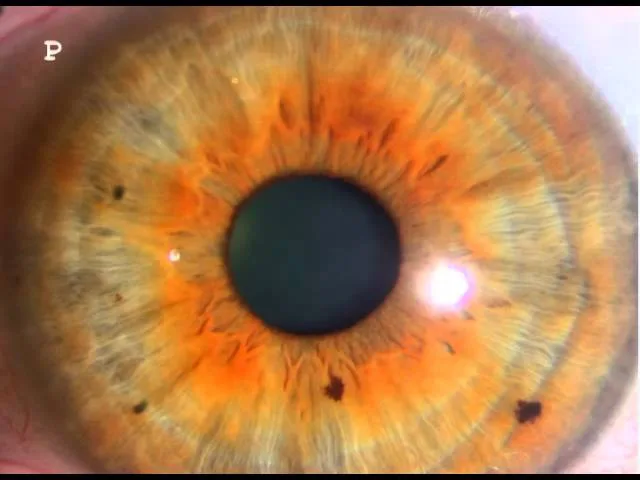 Cadi Iridology Camera