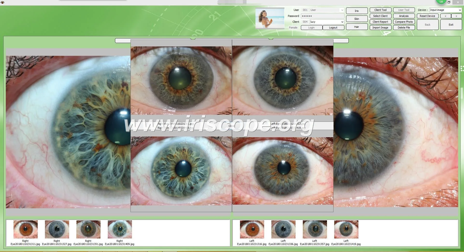 Iris Camera