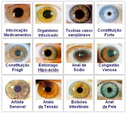 How to read iridology chart?