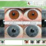 Telecamera per iridologia per Mac