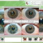 Telecamera per iridologia per Mac