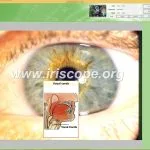 Telecamera per iridologia Jensen