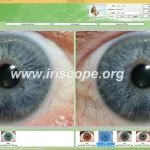 Telecamera per iridologia Jensen