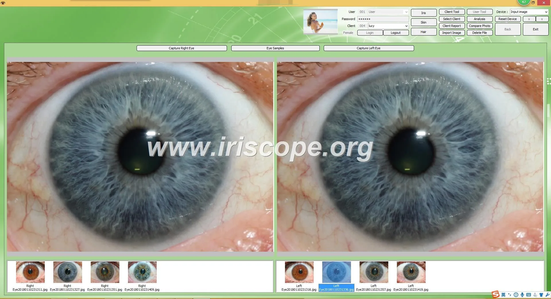 Câmera Iridologia Jensen