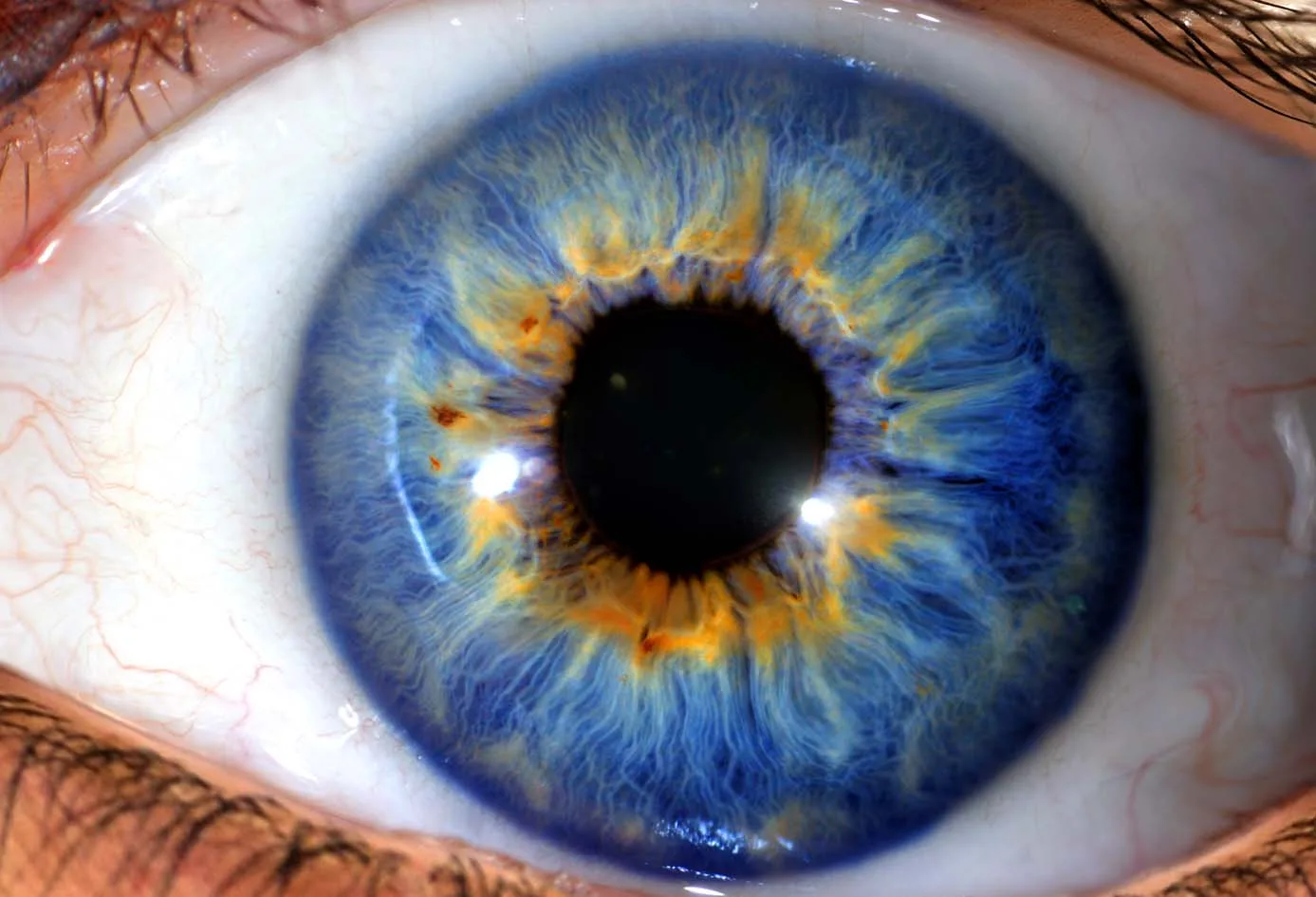 Used Iridology Cameras for Sale