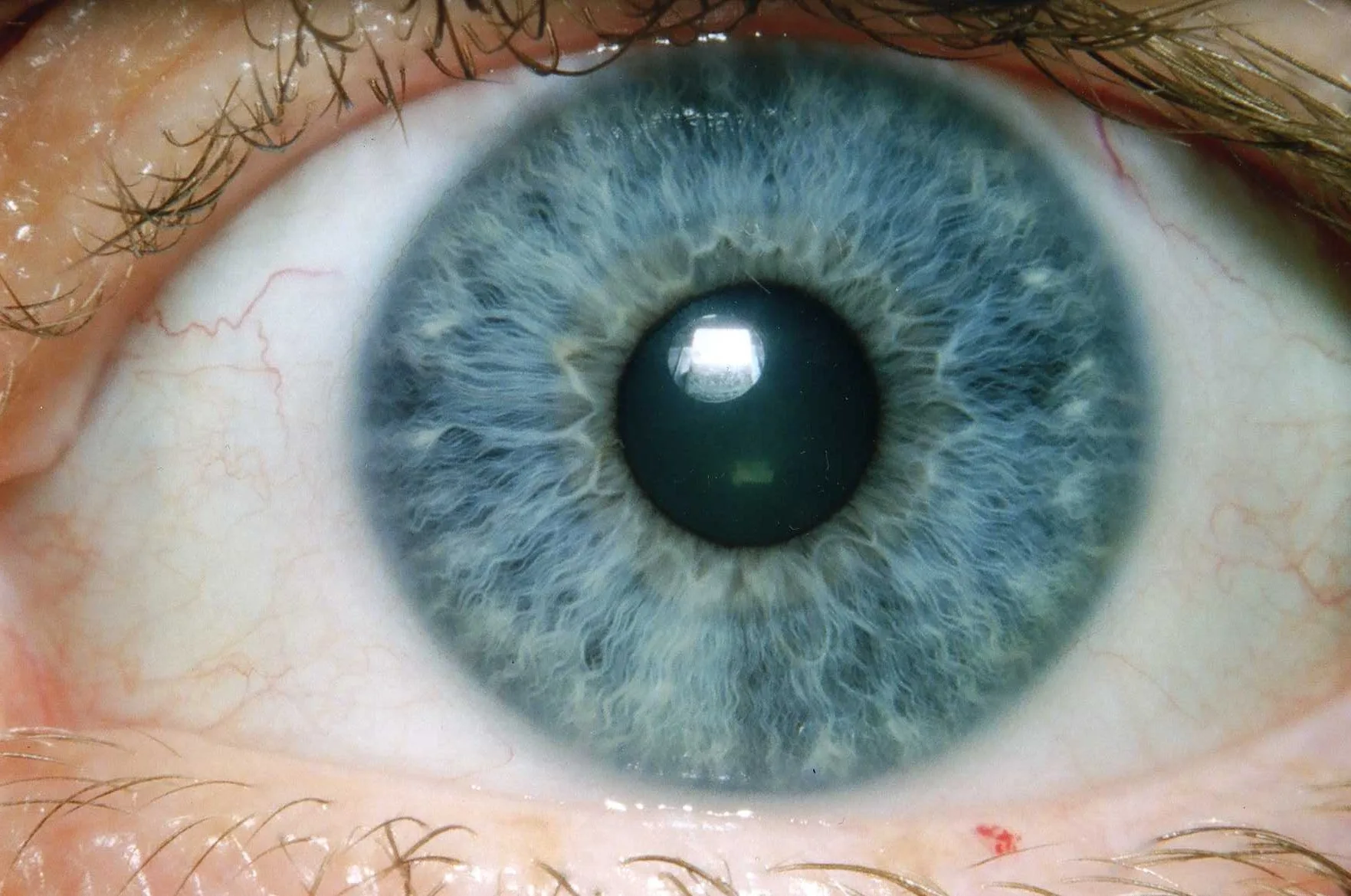 Used Iridology Cameras for Sale