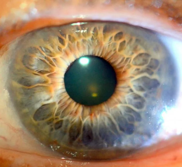 Used Iridology Cameras for Sale