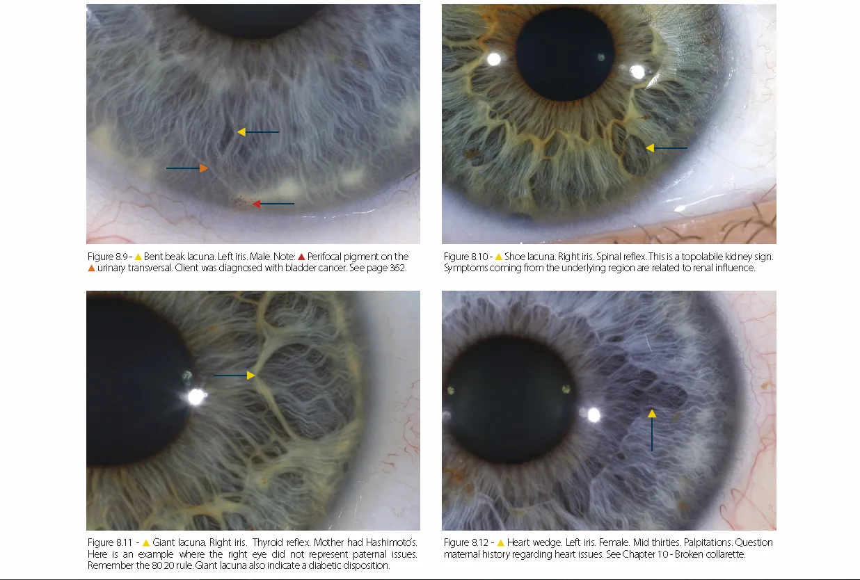 como ler iridologia dos olhos