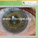 Supporto e software per telecamera per iridologia MAIKONG