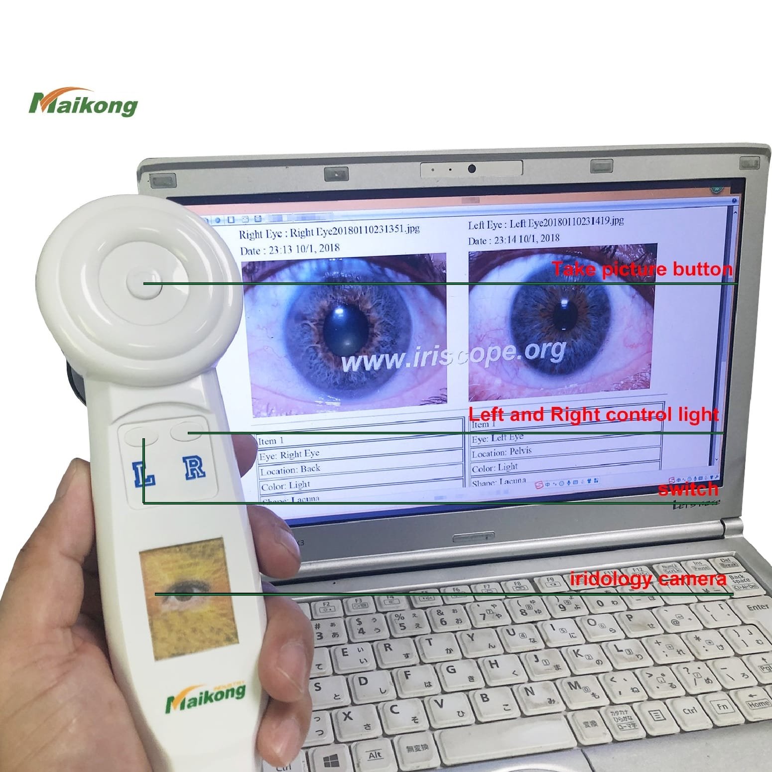 How to Take a Picture of Your Eye for Iridology? Um guia abrangente