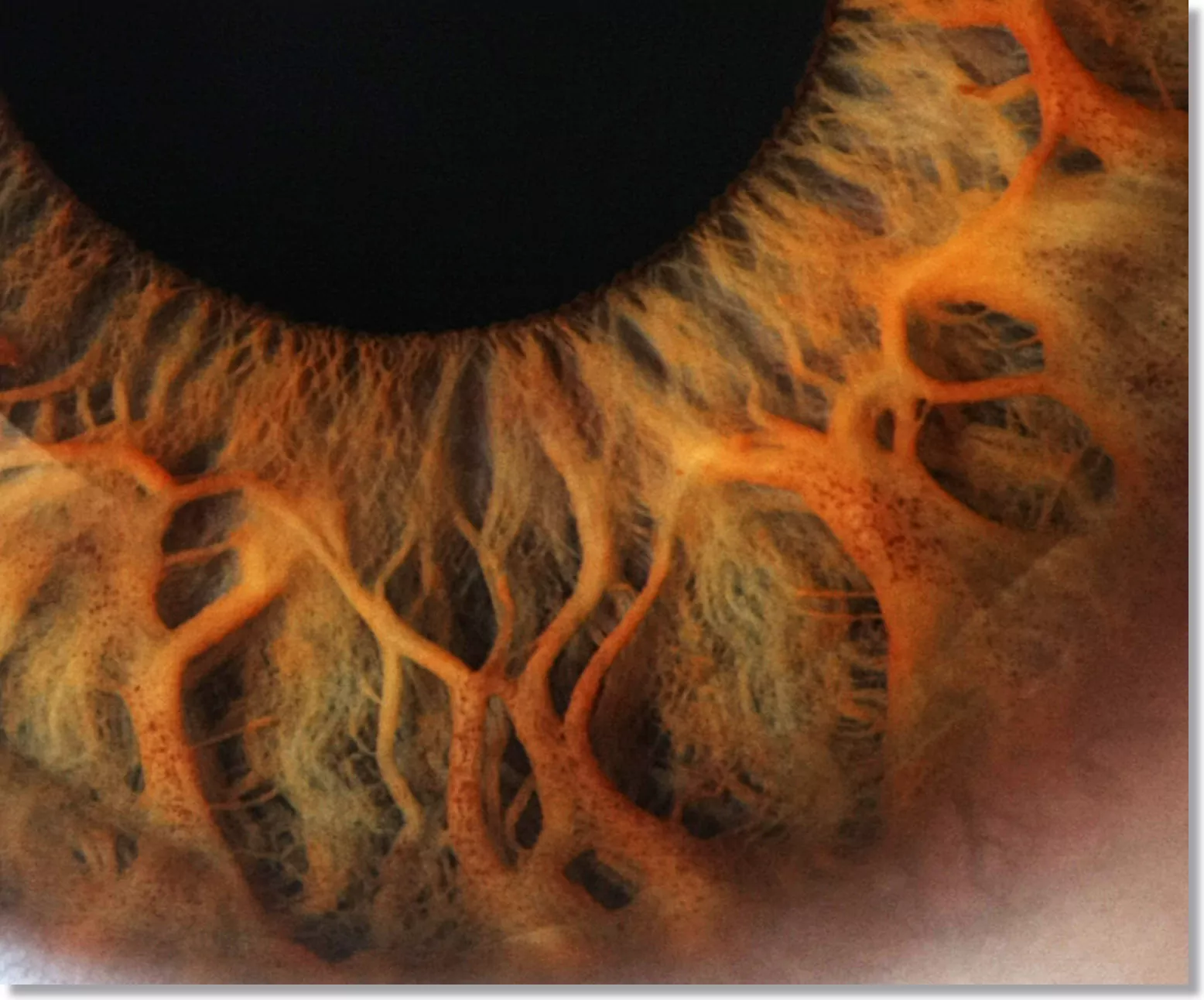 Cómo tomar una fotografía de tus ojos para iridología?