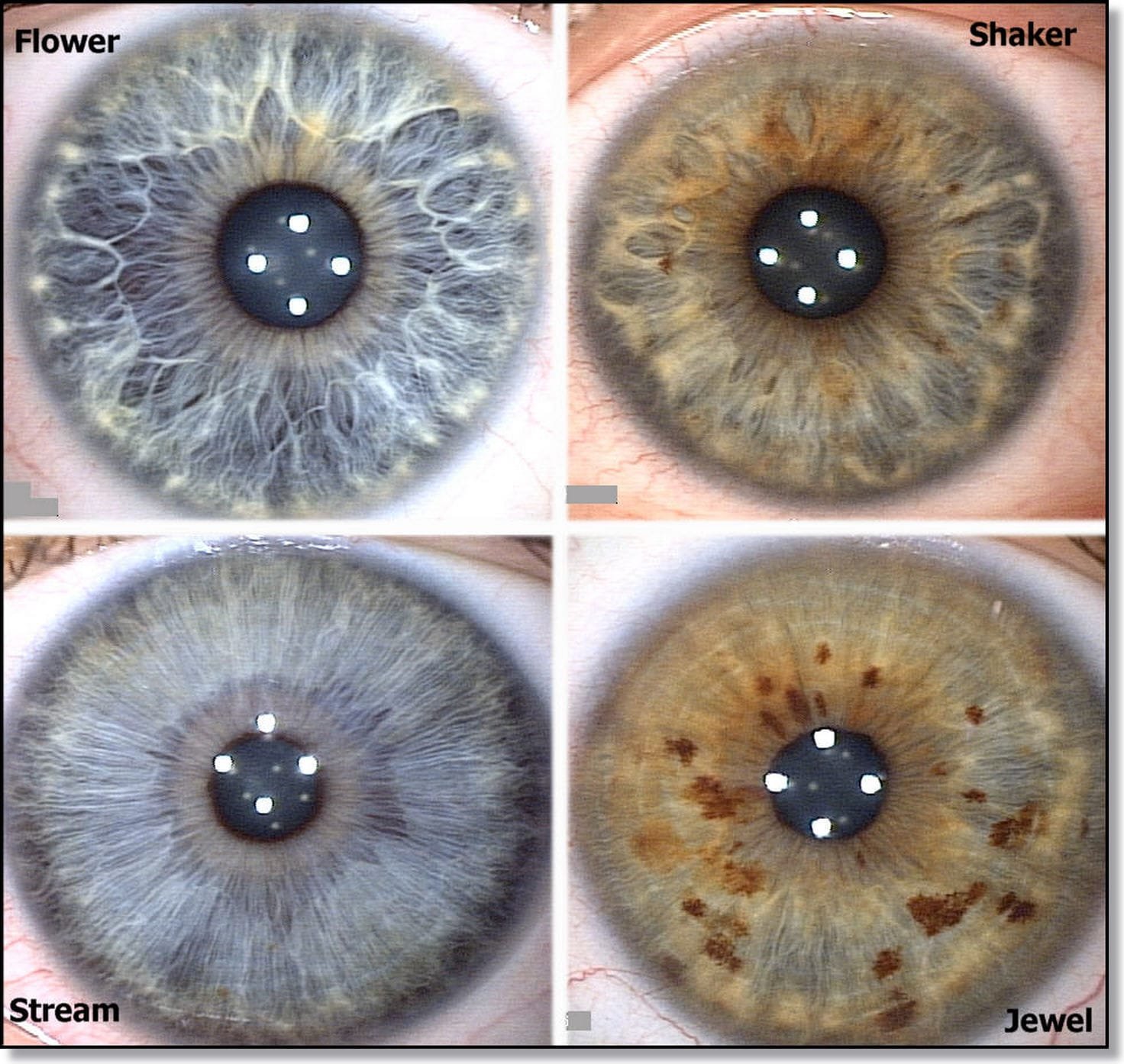 Iridología: Cómo leer el ojo?