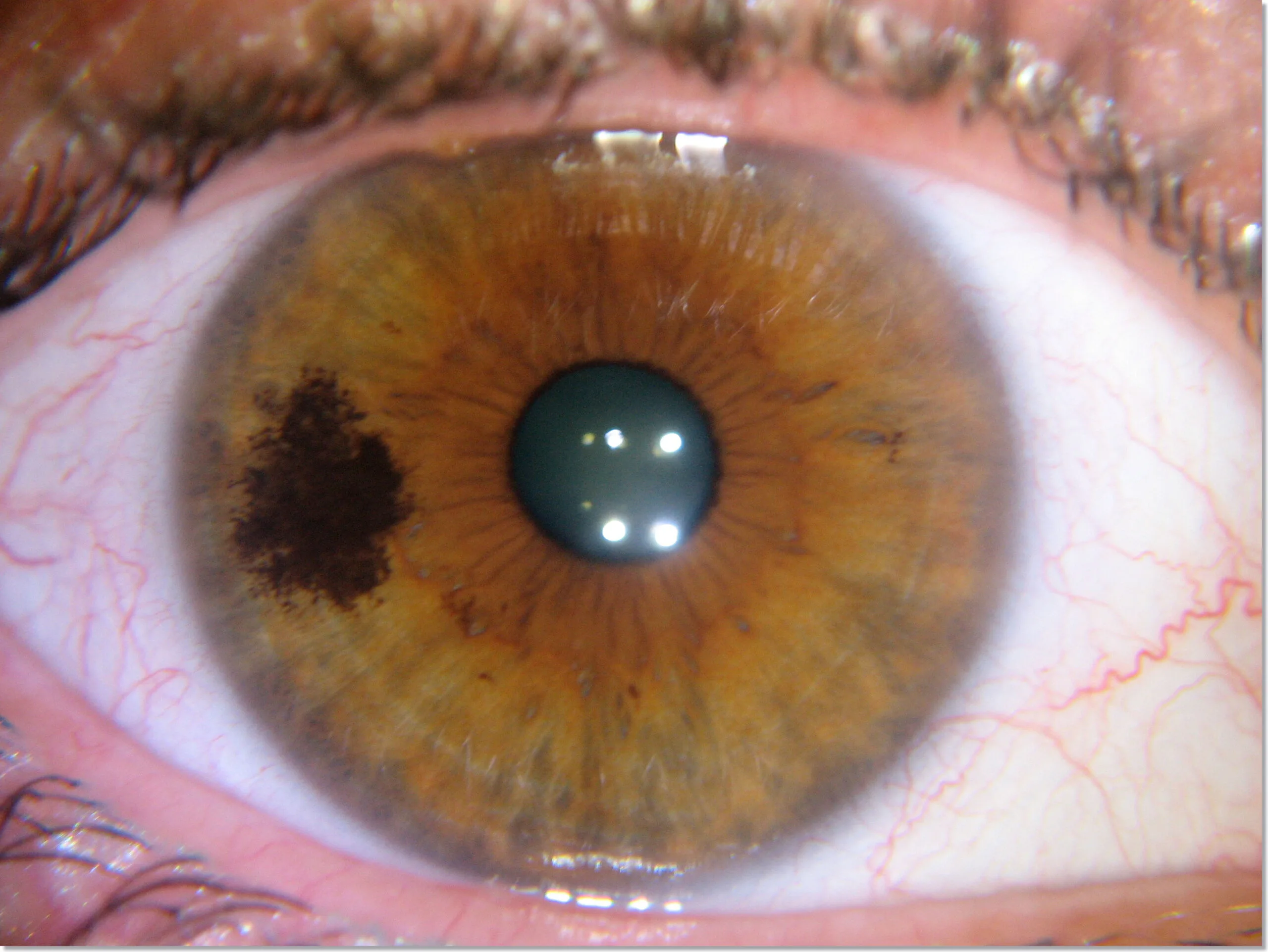 Tabela de cores dos olhos Iridology Marrom