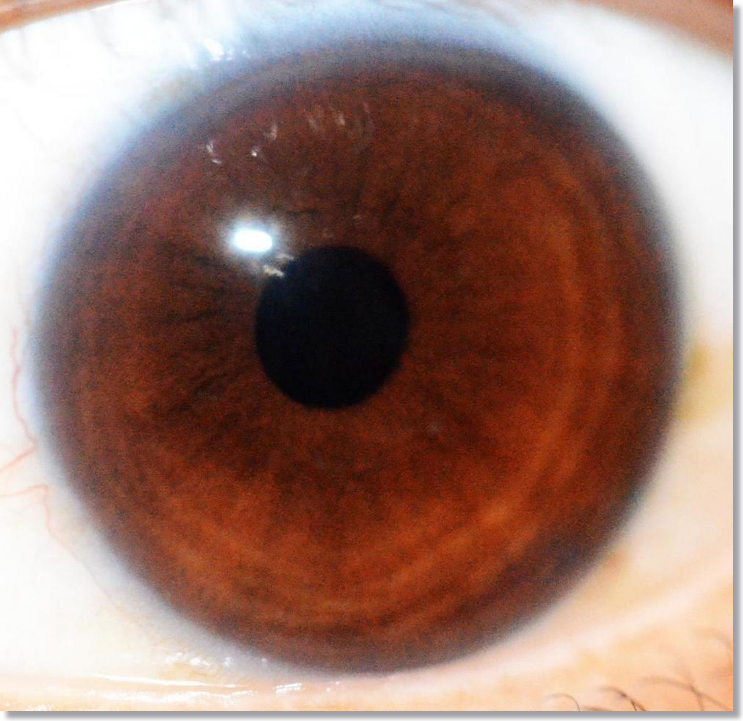 Carta de colores de ojos de Iridología Marrón