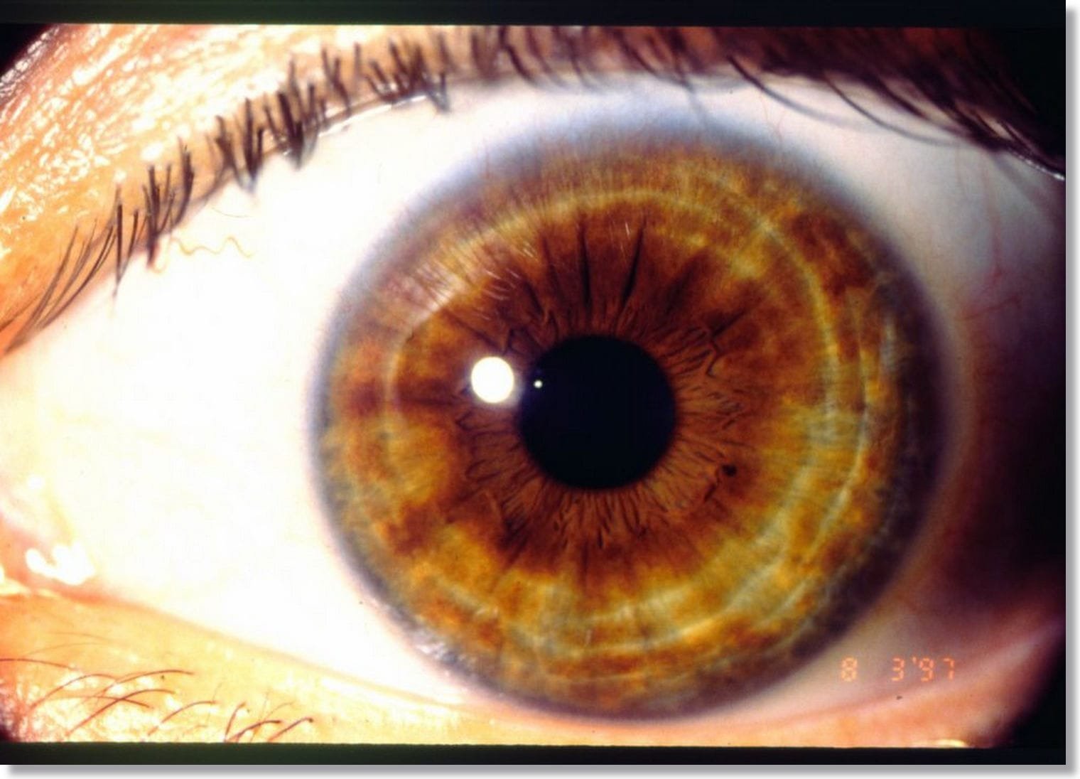 Carta de colores de ojos de Iridología Marrón