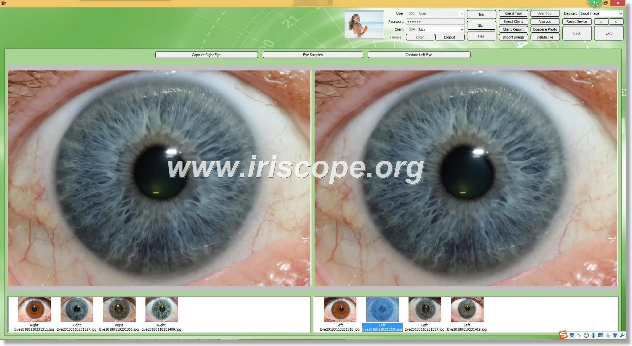Software Maic Iriscope
