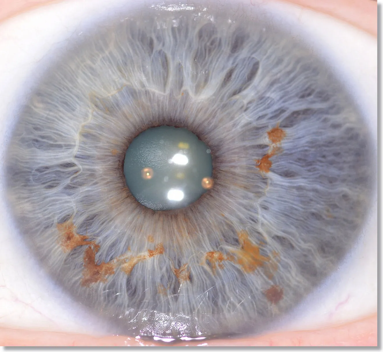 YouTube: How to Take a Clear Picture for Iridology?