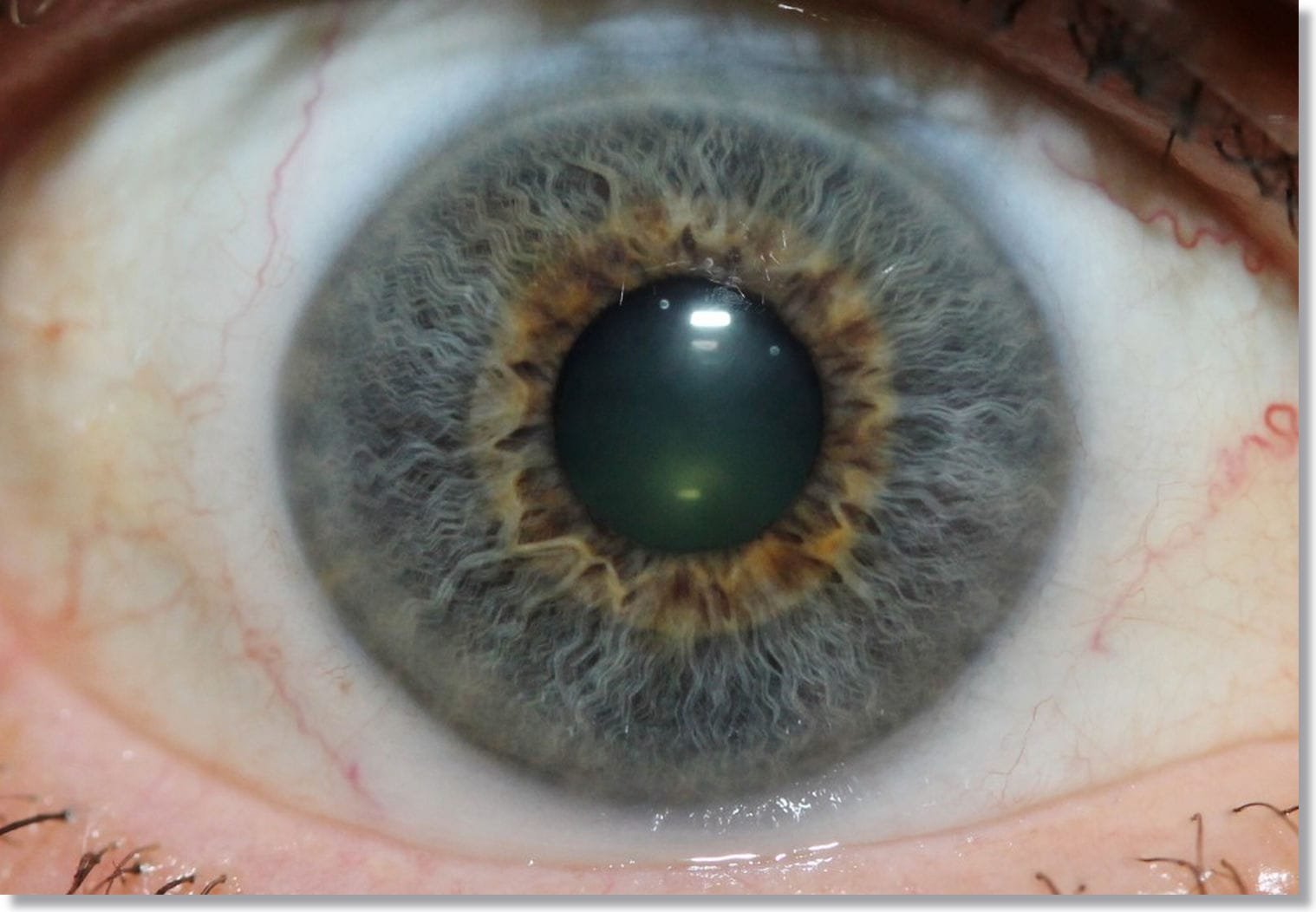 YouTube: Cómo tomar una fotografía clara para iridología?