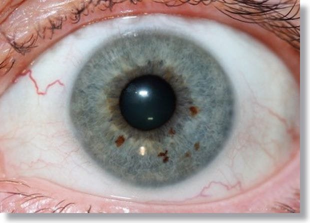 YouTube: Cómo tomar una fotografía clara para iridología?