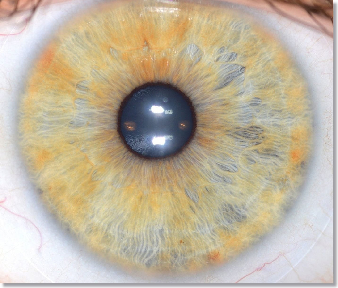 YouTube: Cómo tomar una fotografía clara para iridología?