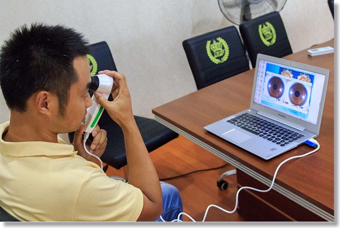 YouTube: Cómo tomar una fotografía clara para iridología?