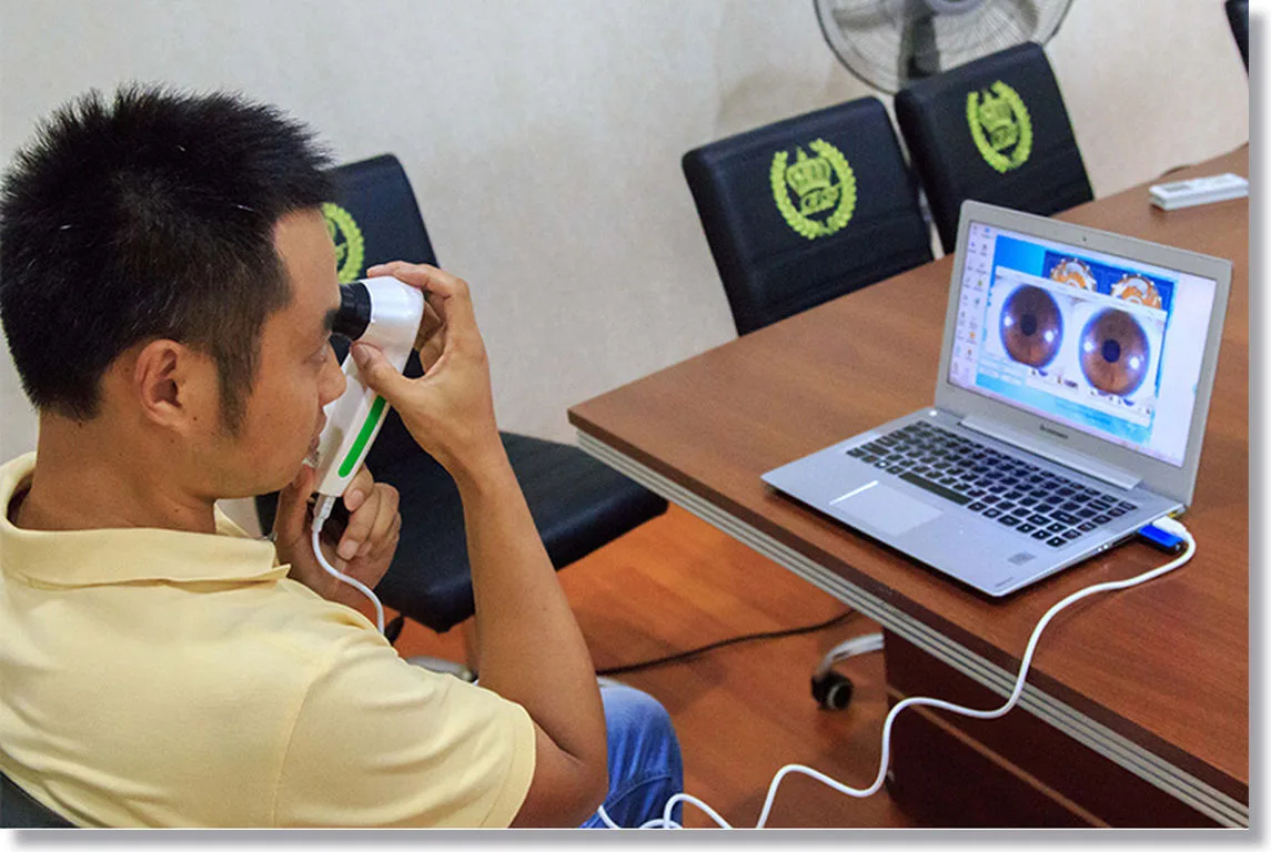 YouTube: How to Take a Clear Picture for Iridology?