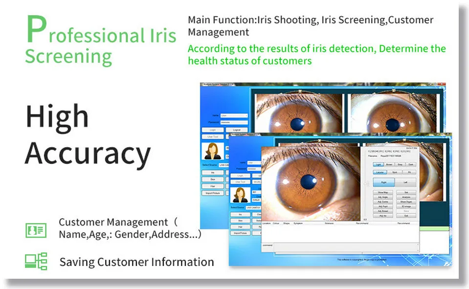 Digitales Iriskop von Eyepix Pro