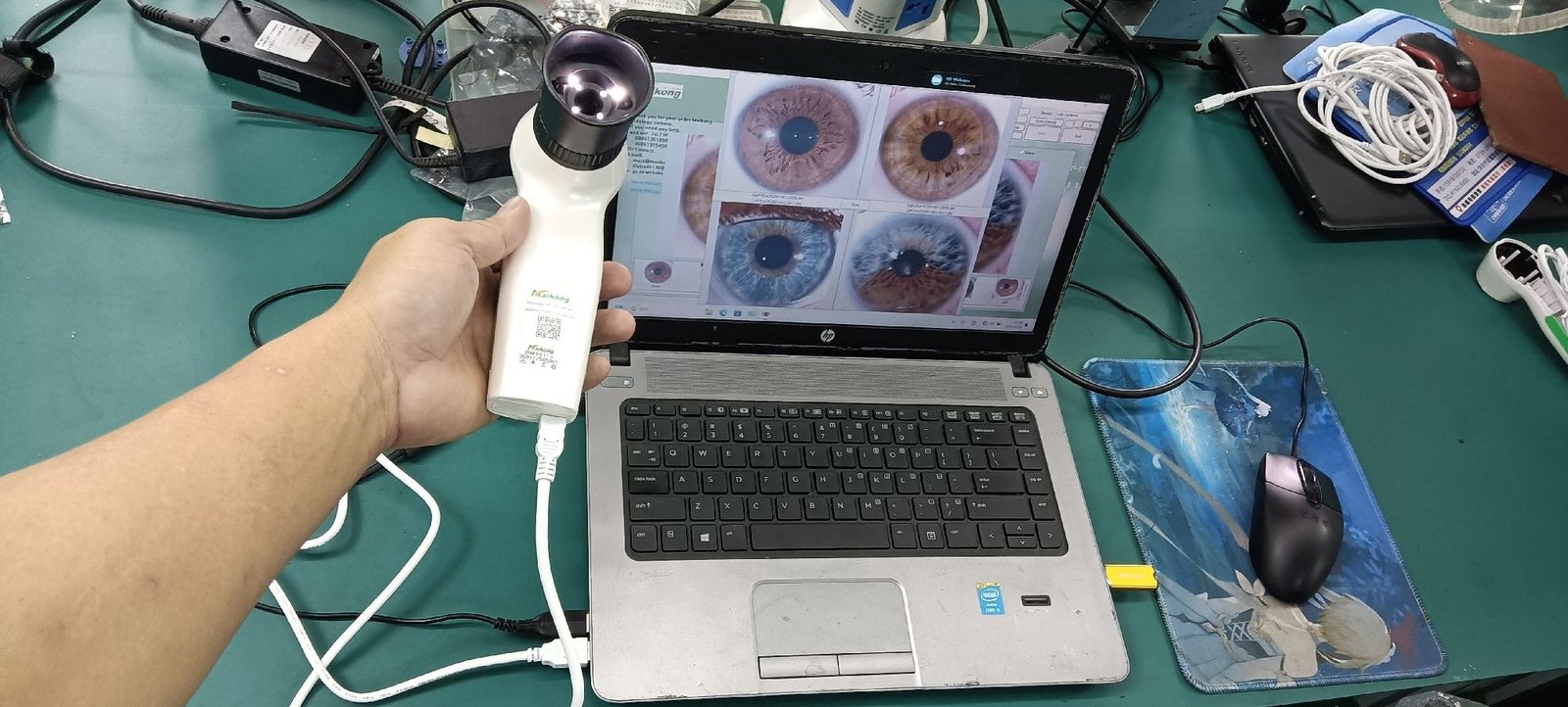 maikong iridology camera software