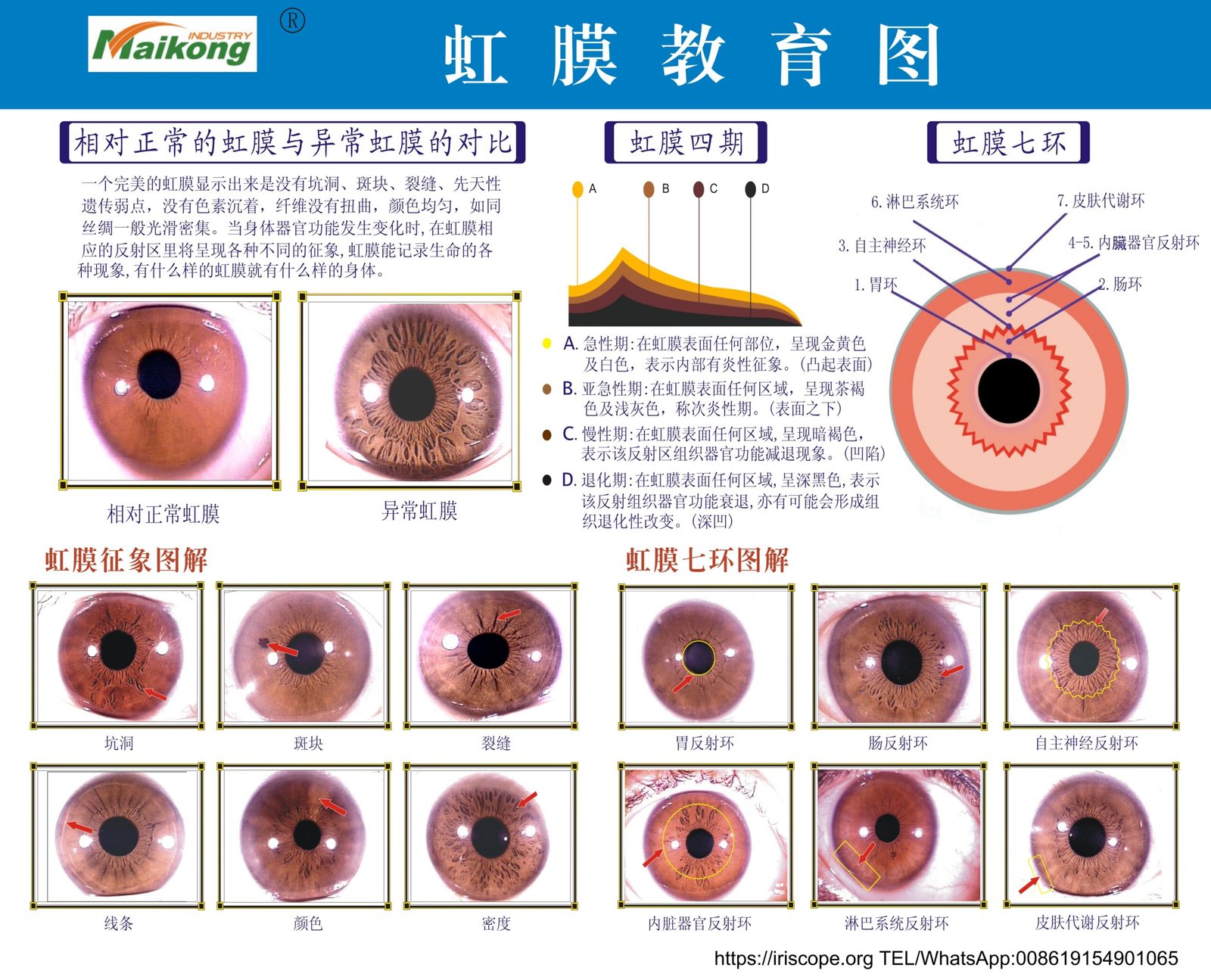 Which iridology software should a Herbalist in South Africa consider — practical choices and why — MAIKONG iridologia mapa (24).jpg