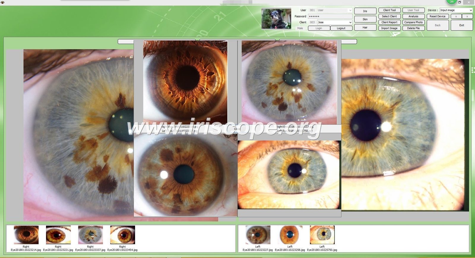 maikong iridology camera software