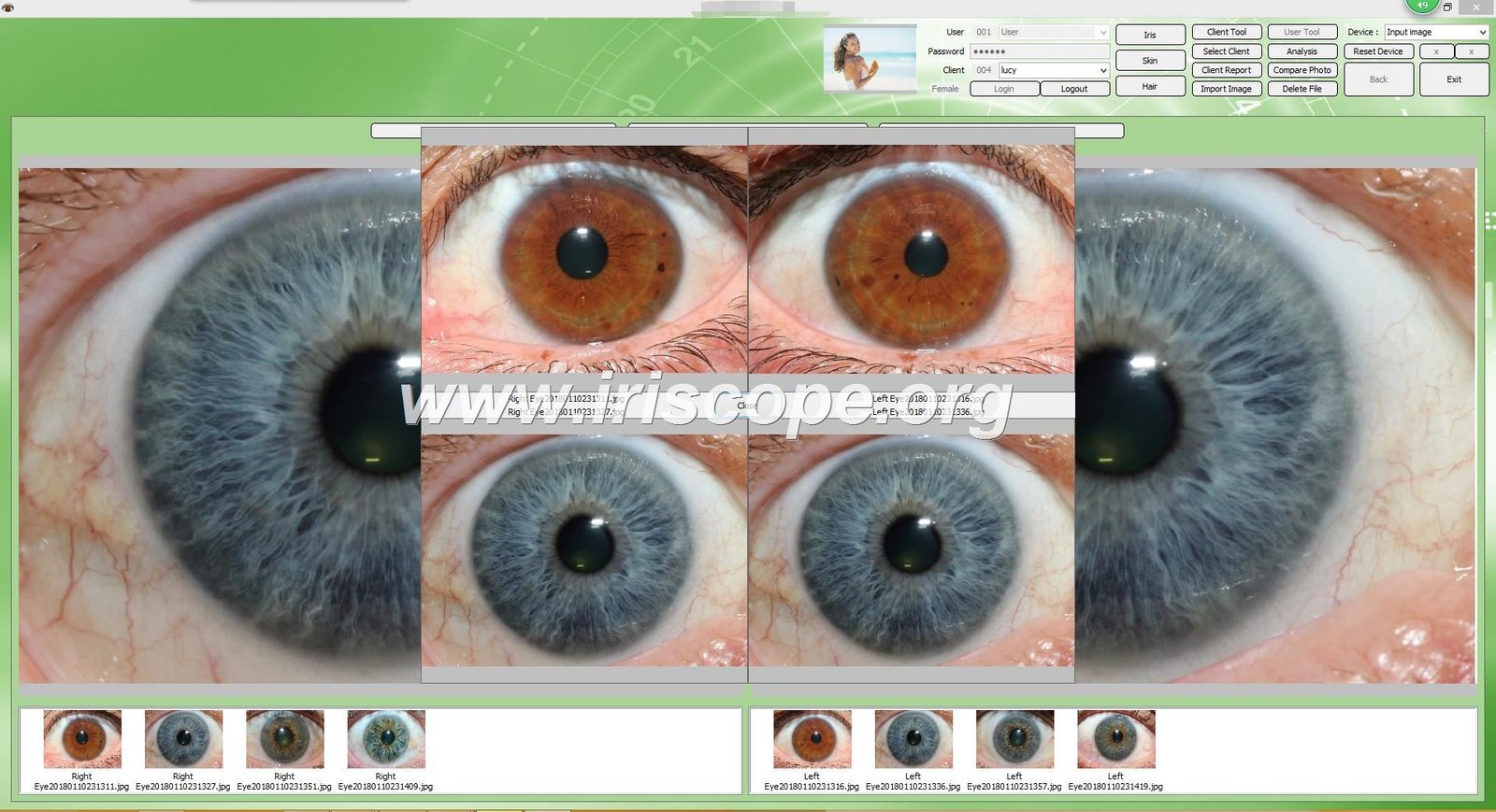 MAIKOGN IRIDOLOGY SOFTWARE