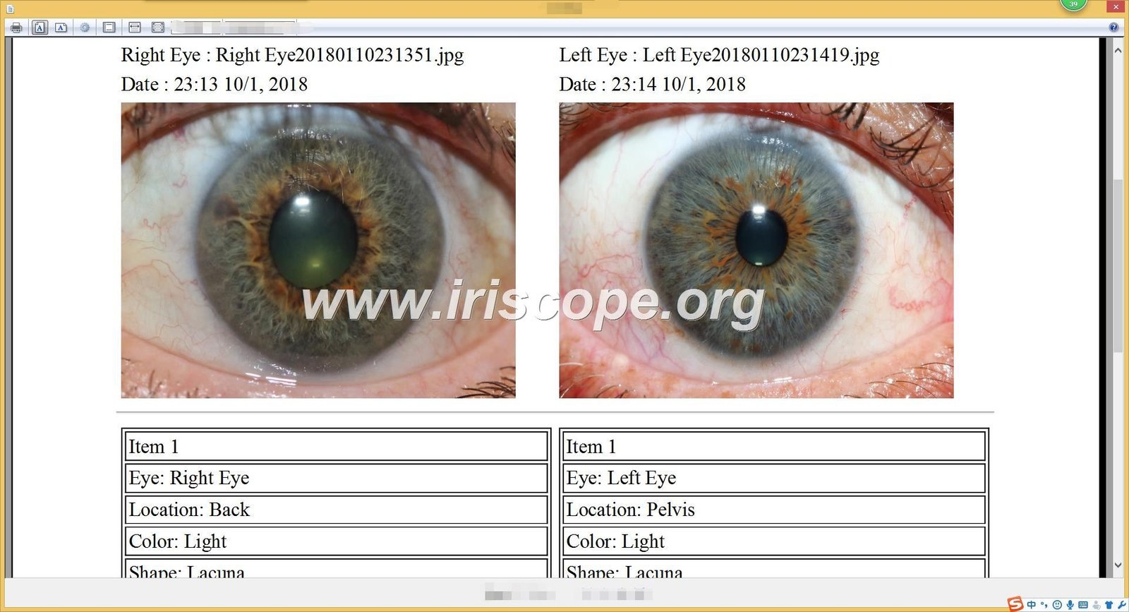 MAIKOGN IRIDOLOGY SOFTWARE