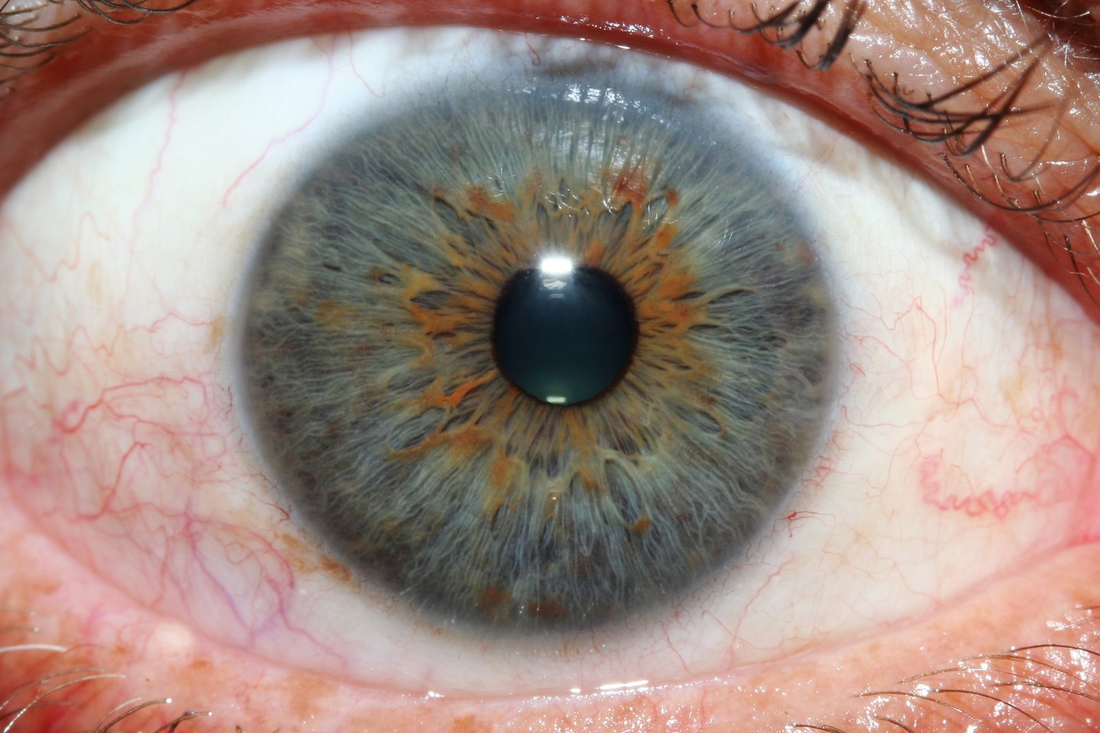 iridology-eys-images-1