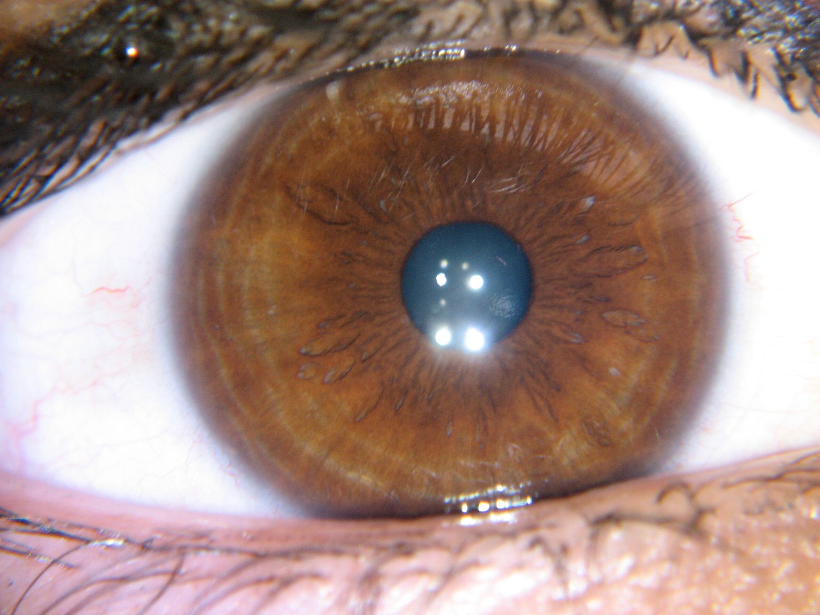 Close-up capture of human iris stroma using optical magnification equipment