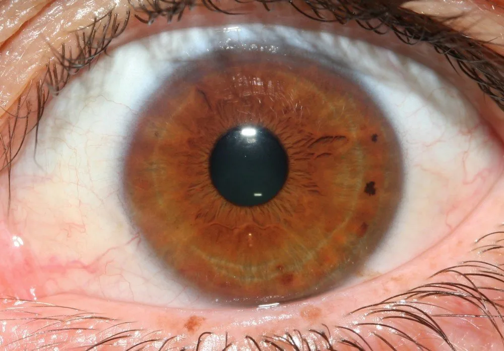 Best iriscope manufacturers for Professional Iridologists in South Africa — a concise buying answer — iridology images 5.jpg