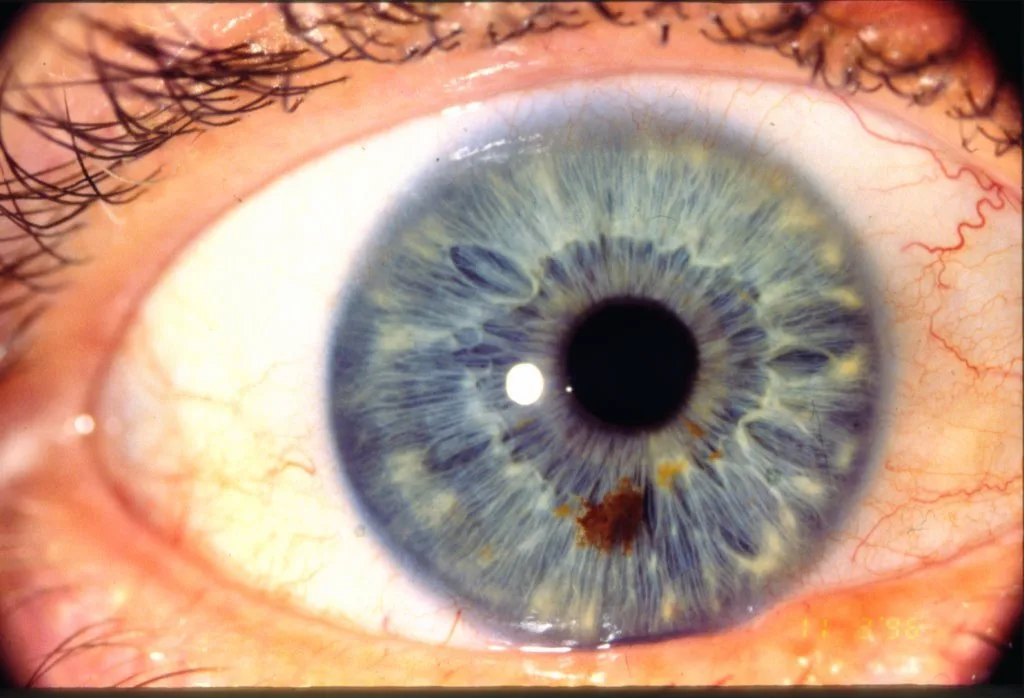 iriscopio procurement: the exact comparison checklist OEM / private‑label buyers in South Africa need — iridology picture.jpg