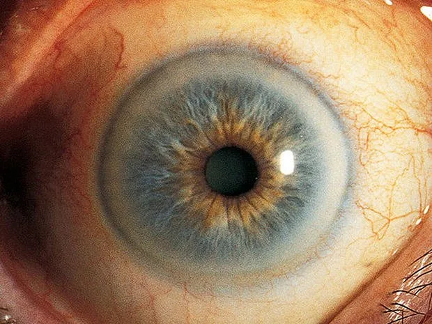 iriscopio procurement: the exact comparison checklist OEM / private‑label buyers in South Africa need — iridology pictures 3.jpg