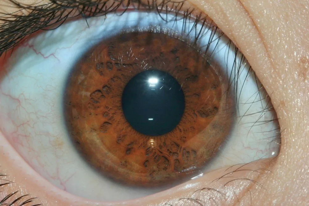 Which companies supply iridology cameras to South Africa — practical answer for Holistic Practitioners — iridology images 21.jpg