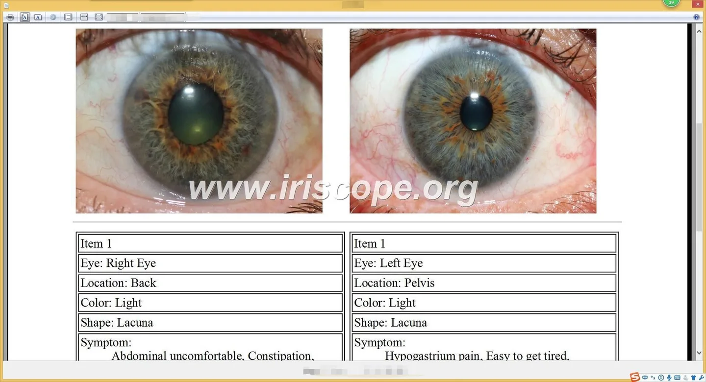 Which iridology software should a Herbalist in South Africa consider — practical choices and why — Software de Iridología (53).JPG