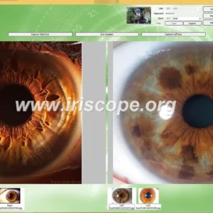 Which iridology software should a Herbalist in South Africa consider — practical choices and why — Software de Iridología (55).JPG