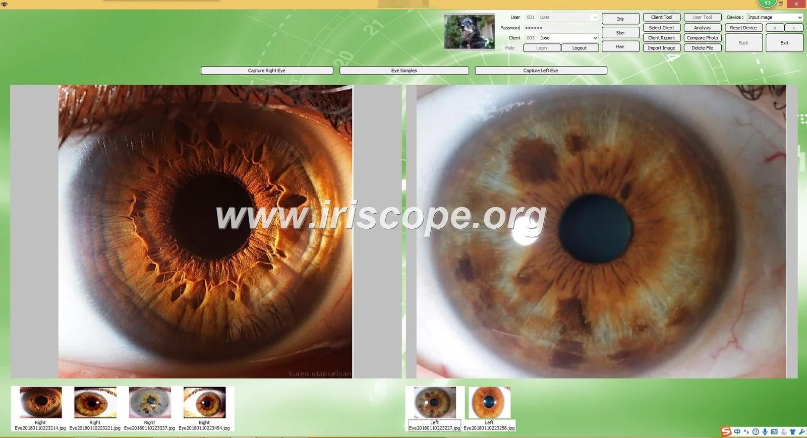 Which iridology software should a Herbalist in South Africa consider — practical choices and why — Software de Iridología (55).JPG